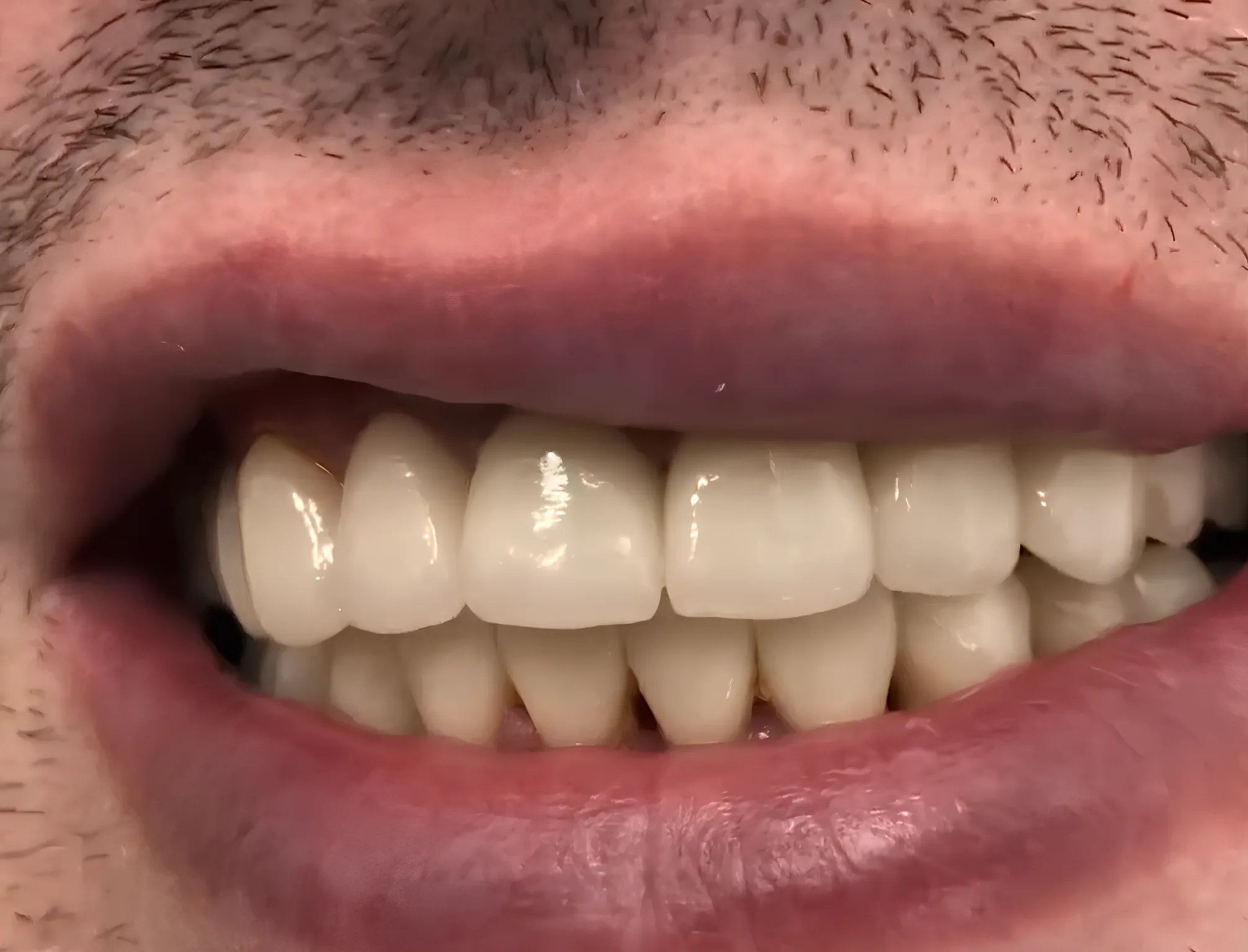 Преображение улыбки. Комплексная работа